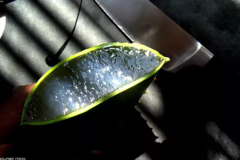 Remedii naturale pentru arsuri ușoare cu aloe vera și miere