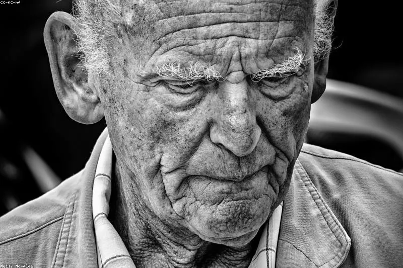 Leacuri naturale pentru dermatita periorală