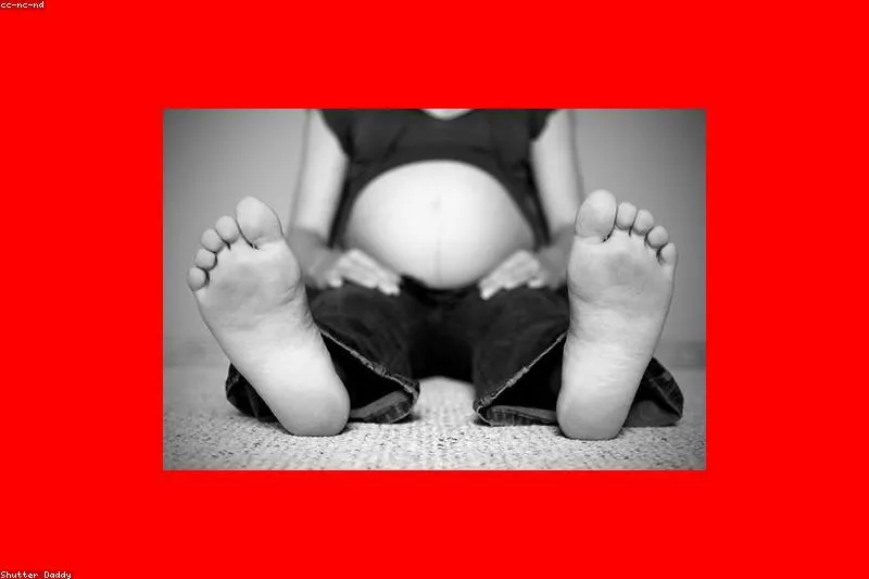 Natural remedies for pregnancy edema: elevated legs, compression, gentle diuretic foods