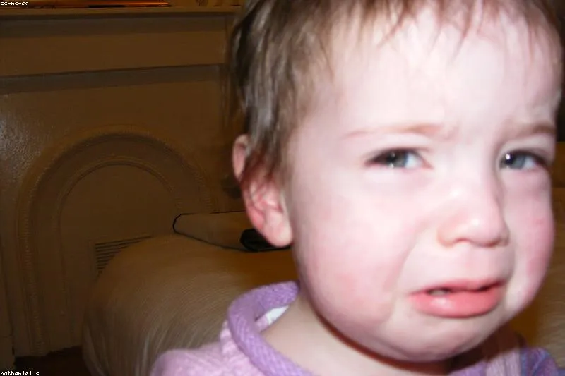 Pojar la copil cu erupție cutanată caracteristică